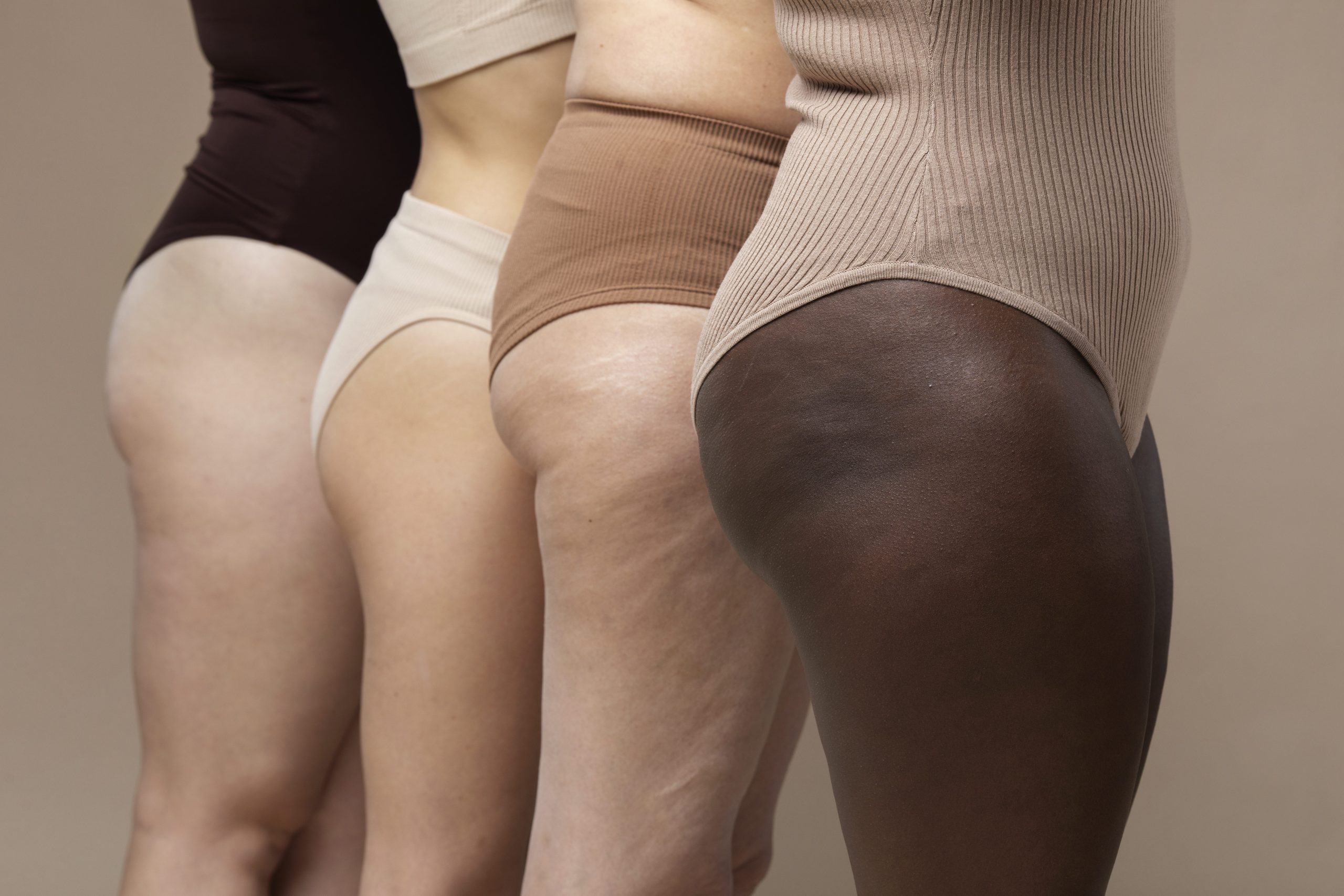 Stretch Marks & Soft Power